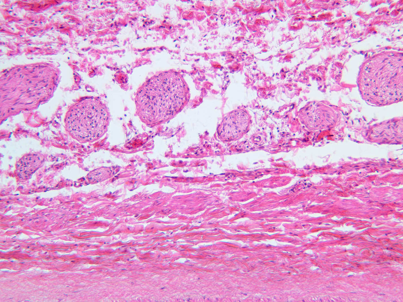 a28 simple squamous epithelium renal artery vein 10x he.jpg